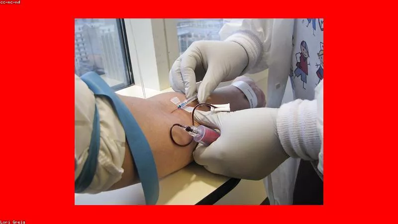 Phân tích y khoa hình ảnh Cách bảo vệ mắt khi dùng màn hình nhiều giờ mỗi ngày